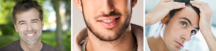 Hair Restoration Toronto